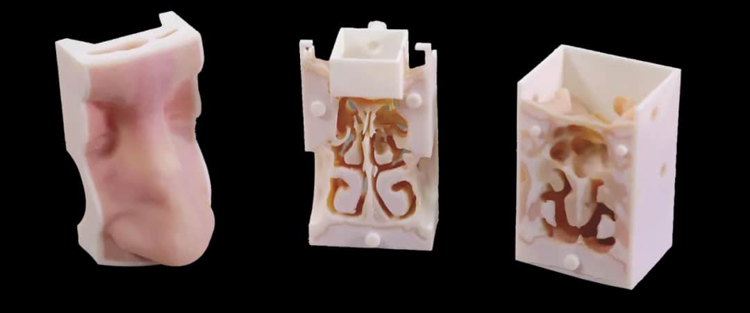 Nos do druku 3D: Przełom w medycynie rekonstrukcyjnej